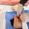 ETSS Training für Wunden & Verletzungen