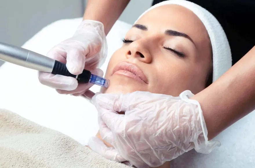 Microneedling München