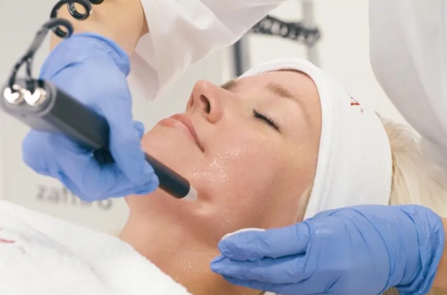 Microneedling München